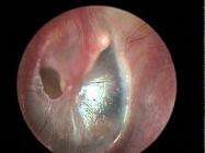 ���u�� ��