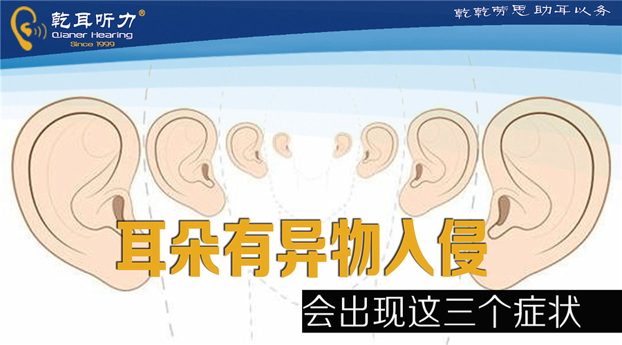 �����Ю��������������F(xi��n)�@����(g��)�Y����Ո���r(sh��)������